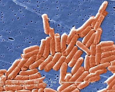 Salmonella, a causa mais comum de surtos de origem alimentar na União Europeia