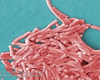 Legionella - Como se contrai e previne?